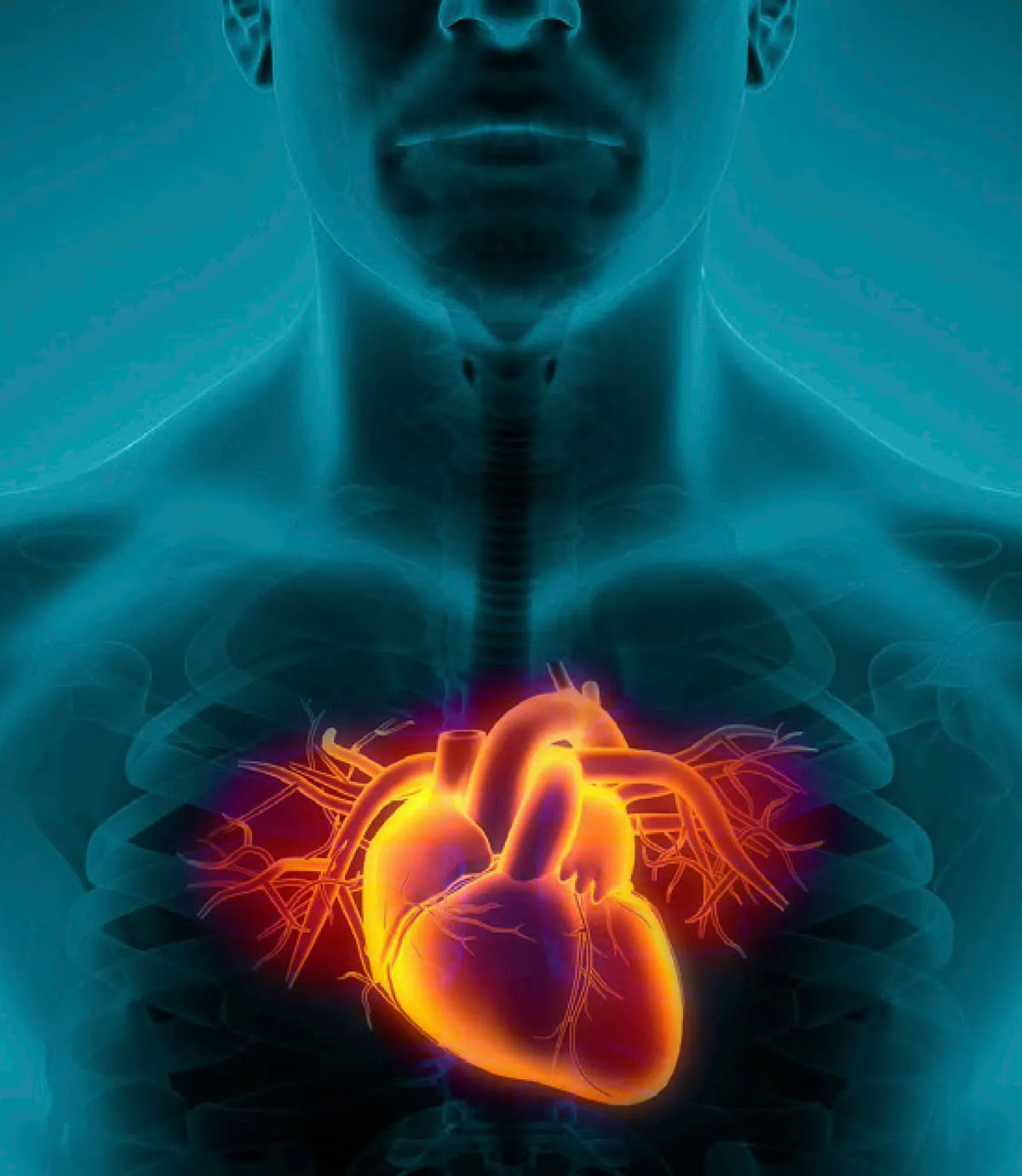 Angiogram (Coronary & Peripheral)